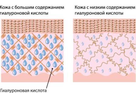 Hyal_derma.jpg